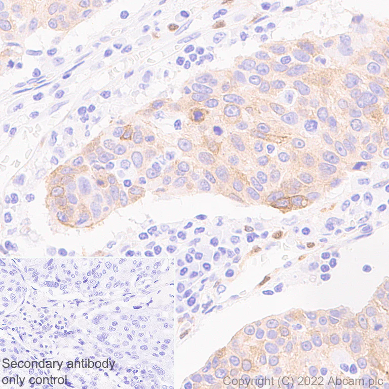 Immunohistochemistry (Formalin/PFA-fixed paraffin-embedded sections) - Anti-NOTCH3 antibody [EPR25183-101] (AB300527)