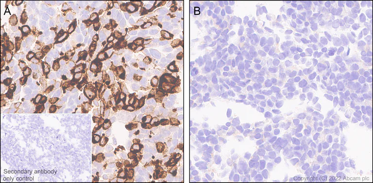 Immunohistochemistry (Formalin/PFA-fixed paraffin-embedded sections) - Anti-NOTCH3 antibody [EPR25183-101] (AB300527)