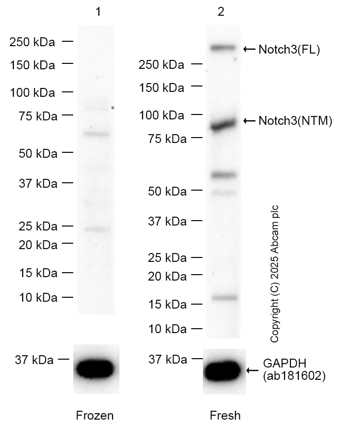 Anti-NOTCH3 antibody [EPR25183-101] (ab300527) | Abcam