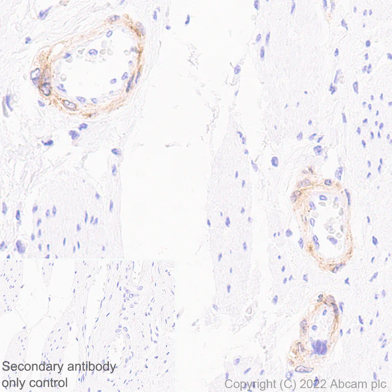 Immunohistochemistry (Formalin/PFA-fixed paraffin-embedded sections) - Anti-NOTCH3 antibody [EPR25183-101] (BSA and Azide free) (AB300528)
