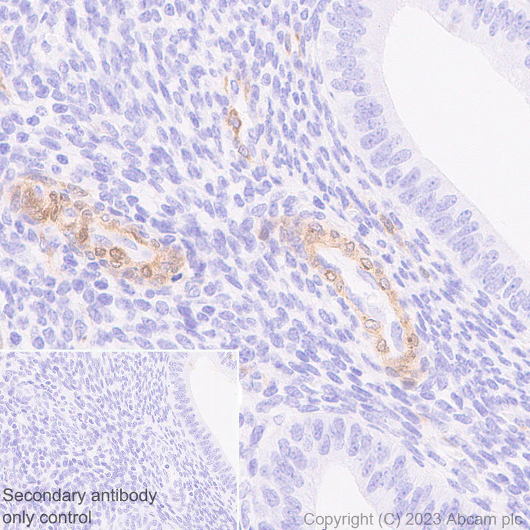 Immunohistochemistry (Formalin/PFA-fixed paraffin-embedded sections) - Anti-NOTCH3 antibody [RM1102] (AB315348)