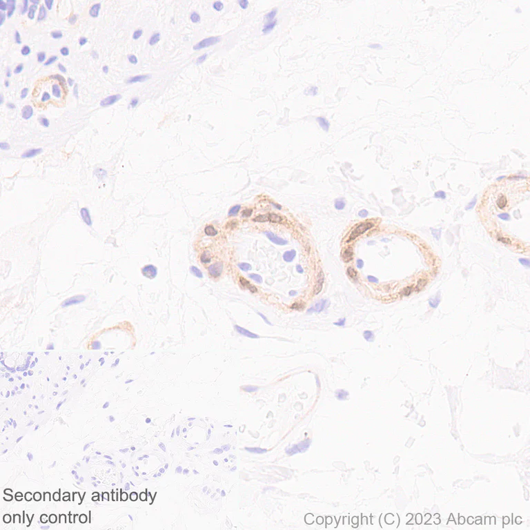 Immunohistochemistry (Formalin/PFA-fixed paraffin-embedded sections) - Anti-NOTCH3 antibody [RM1102] (AB315348)
