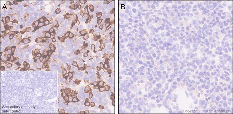 Immunohistochemistry (Formalin/PFA-fixed paraffin-embedded sections) - Anti-NOTCH3 antibody [RM1102] - BSA and Azide free (AB315349)