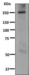 Western blot - Anti-NOTCH4 antibody [EPNCIR101B] - BSA and Azide free (AB249346)