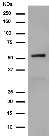 Western blot - Anti-Nova1 antibody [EPR13847] (AB183024)