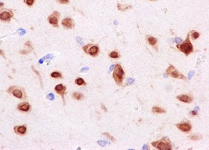 Immunohistochemistry (Formalin/PFA-fixed paraffin-embedded sections) - Anti-Nova1 antibody [EPR13847] - BSA and Azide free (AB232607)