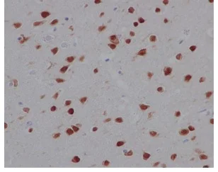 Immunohistochemistry (Formalin/PFA-fixed paraffin-embedded sections) - Anti-Nova1 antibody [EPR13848] - BSA and Azide free (AB250697)