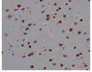 Immunohistochemistry (Formalin/PFA-fixed paraffin-embedded sections) - Anti-Nova1 antibody [EPR13848] - C-terminal (AB183723)
