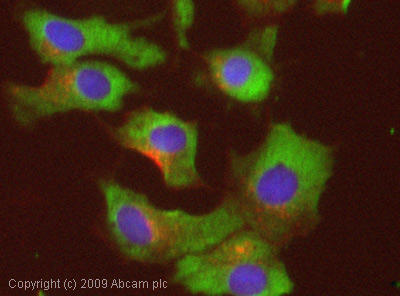 Immunocytochemistry/ Immunofluorescence - Anti-NOX1 antibody (AB55831), expandable thumbnail