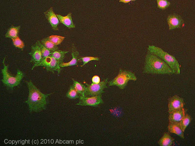 Immunocytochemistry/ Immunofluorescence - Anti-NOX2/gp91phox antibody [54.1] (AB80897)