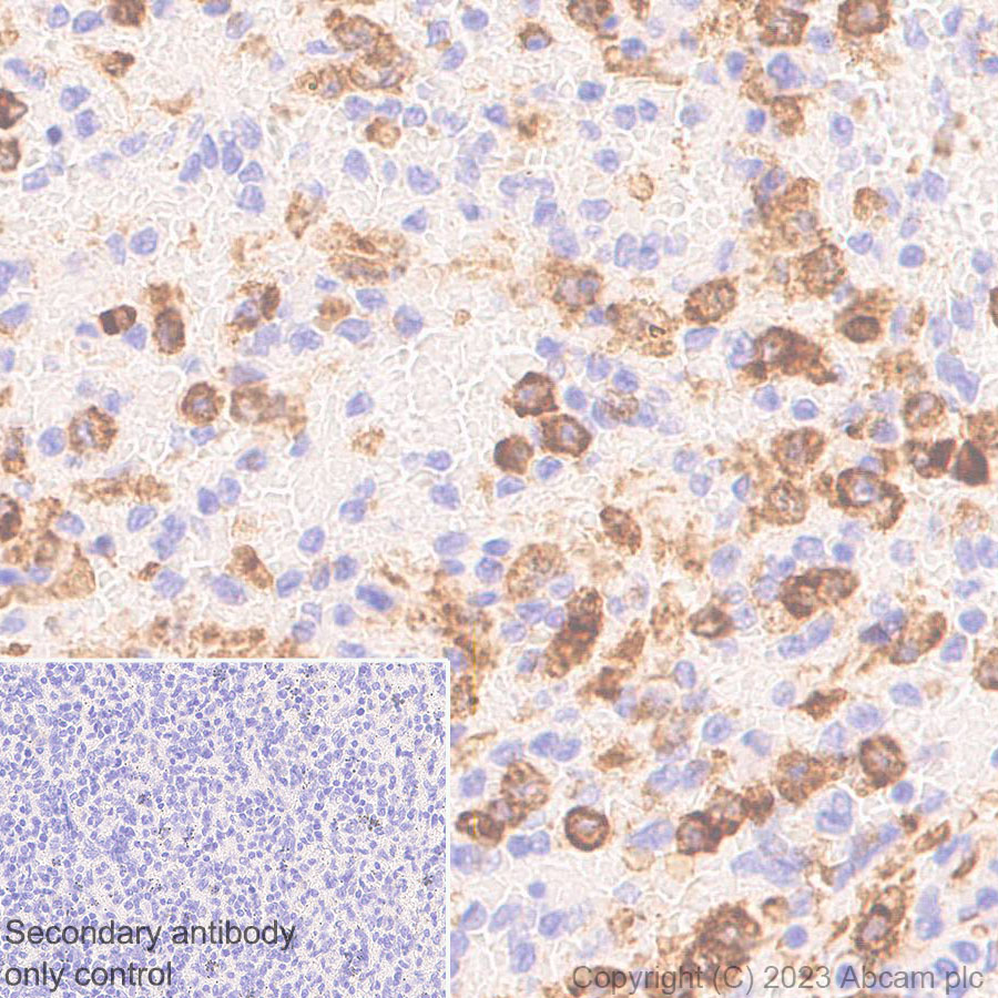 Immunohistochemistry (Formalin/PFA-fixed paraffin-embedded sections) - Anti-NOX2/gp91phox antibody [EPR28415-13] (ab310337), expandable thumbnail