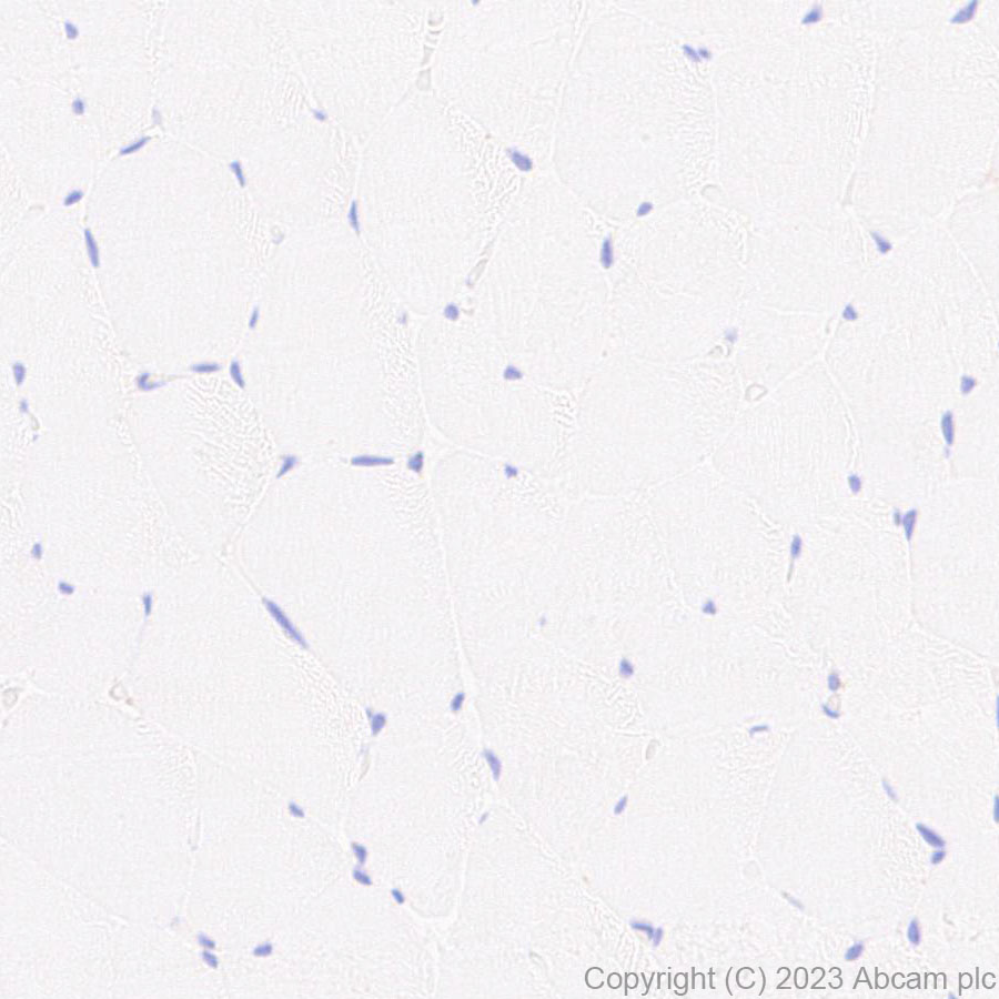 Immunohistochemistry (Formalin/PFA-fixed paraffin-embedded sections) - Anti-NOX2/gp91phox antibody [EPR28415-13] (ab310337), expandable thumbnail
