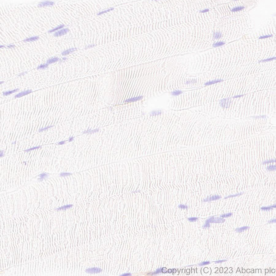 Immunohistochemistry (Formalin/PFA-fixed paraffin-embedded sections) - Anti-NOX2/gp91phox antibody [EPR28415-13] (ab310337), expandable thumbnail