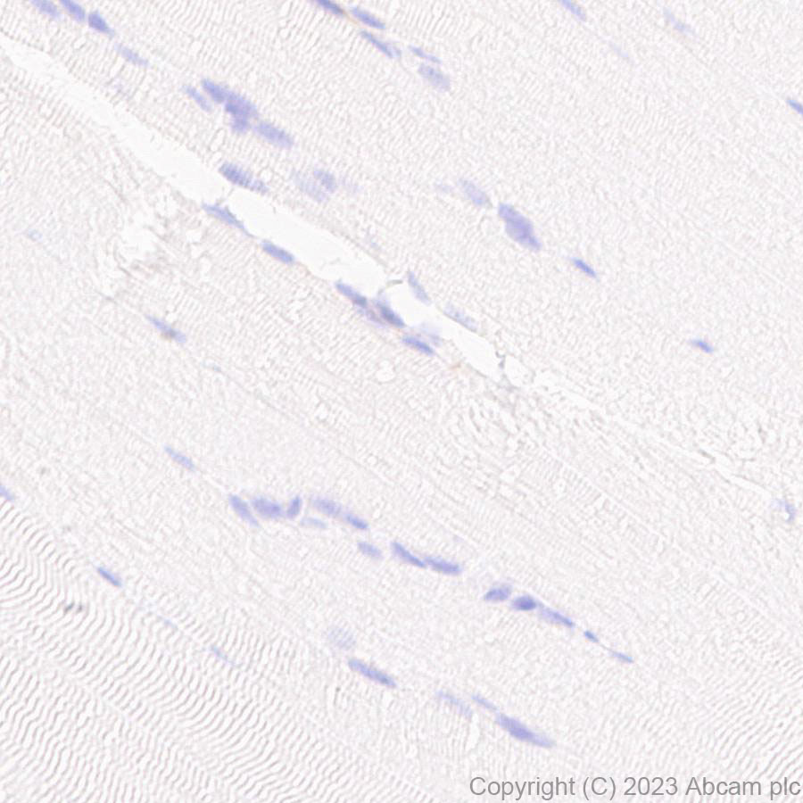 Immunohistochemistry (Formalin/PFA-fixed paraffin-embedded sections) - Anti-NOX2/gp91phox antibody [EPR28415-13] (ab310337), expandable thumbnail