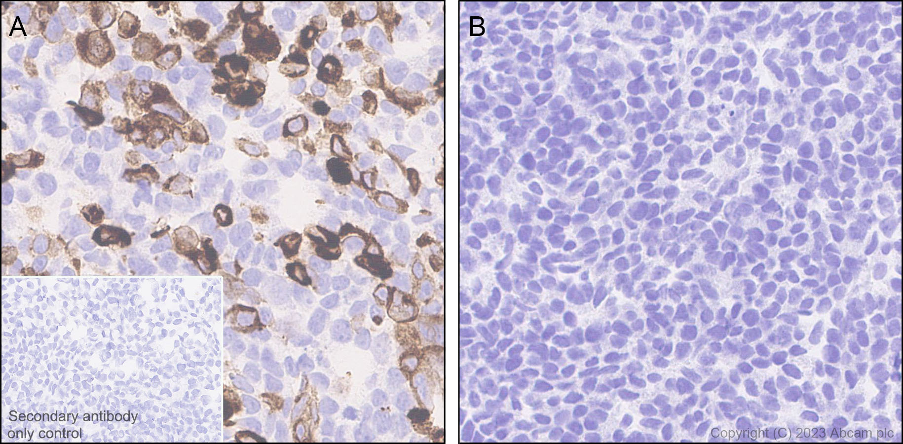 Immunohistochemistry (Formalin/PFA-fixed paraffin-embedded sections) - Anti-NOX2/gp91phox antibody [EPR28415-13] (ab310337), expandable thumbnail