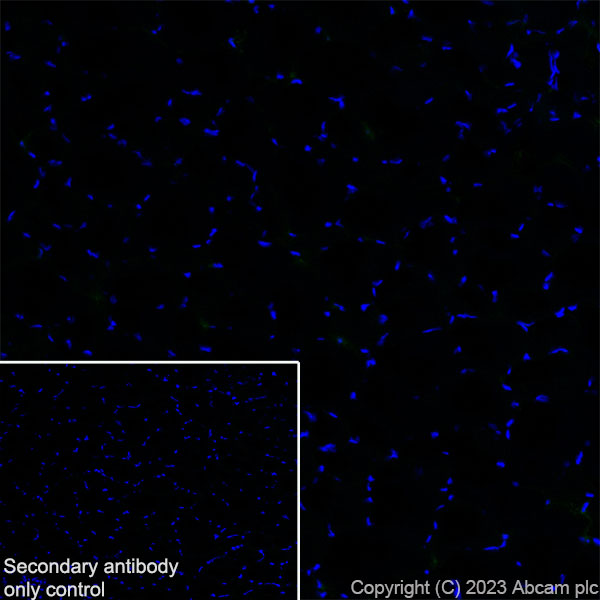 Immunohistochemistry (Frozen sections) - Anti-NOX2/gp91phox antibody [EPR28415-13] (ab310337), expandable thumbnail