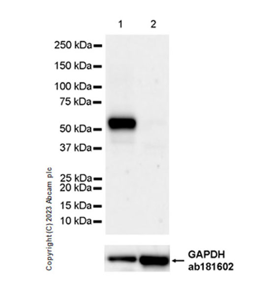 Western blot - Anti-NOX2/gp91phox antibody [EPR28415-13] (AB310337), expandable thumbnail