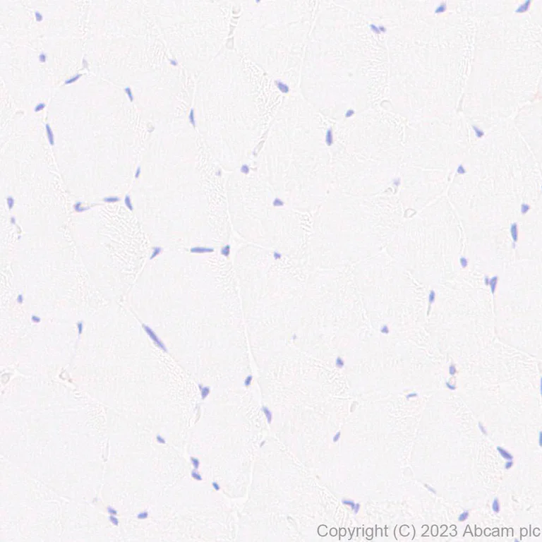 Immunohistochemistry (Formalin/PFA-fixed paraffin-embedded sections) - Anti-NOX2/gp91phox antibody [EPR28415-13] - BSA and Azide free (AB310338)