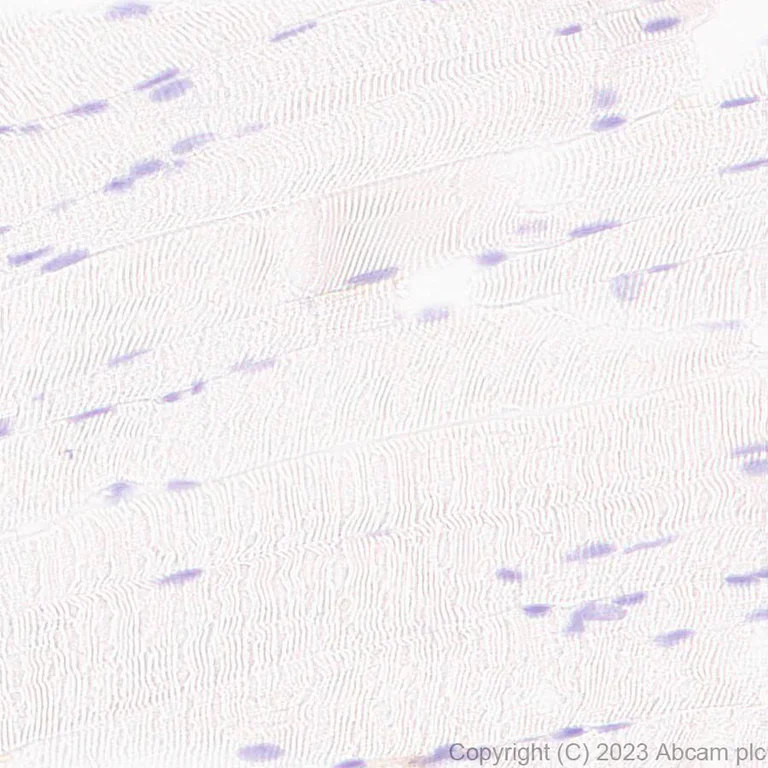 Immunohistochemistry (Formalin/PFA-fixed paraffin-embedded sections) - Anti-NOX2/gp91phox antibody [EPR28415-13] - BSA and Azide free (AB310338)