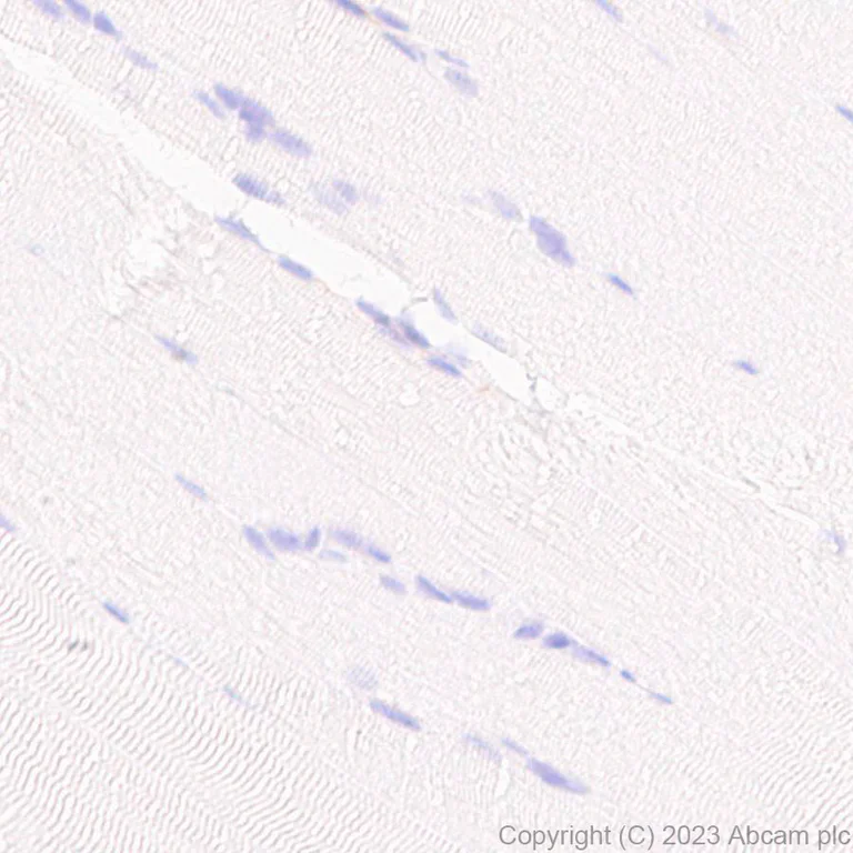 Immunohistochemistry (Formalin/PFA-fixed paraffin-embedded sections) - Anti-NOX2/gp91phox antibody [EPR28415-13] - BSA and Azide free (AB310338)