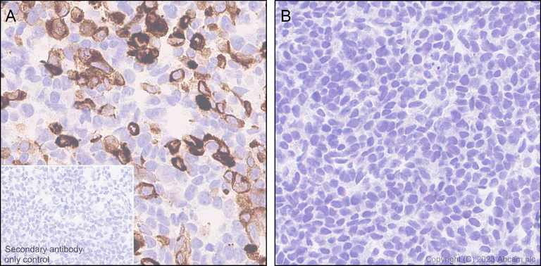 Immunohistochemistry (Formalin/PFA-fixed paraffin-embedded sections) - Anti-NOX2/gp91phox antibody [EPR28415-13] - BSA and Azide free (AB310338)