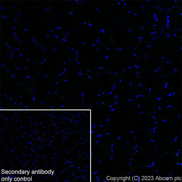 Immunohistochemistry (Frozen sections) - Anti-NOX2/gp91phox antibody [EPR28415-13] - BSA and Azide free (AB310338)