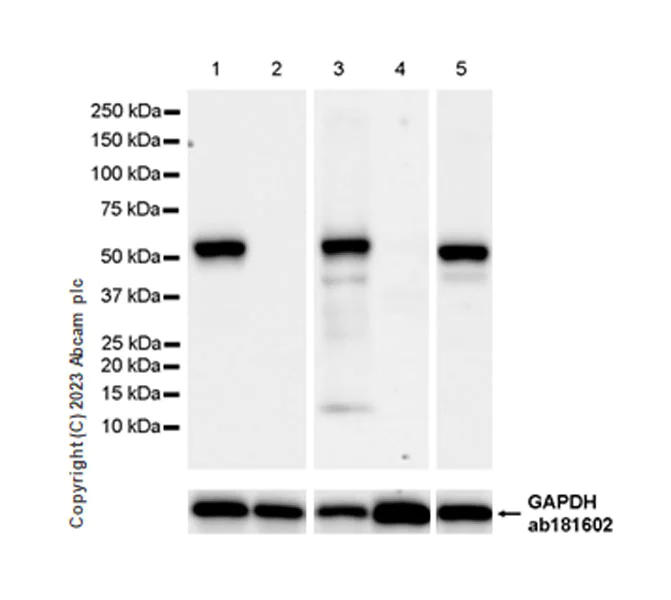 Western blot - Anti-NOX2/gp91phox antibody [EPR28415-13] - BSA and Azide free (AB310338)