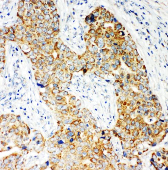 Immunohistochemistry (Formalin/PFA-fixed paraffin-embedded sections) - Anti-NOX5 antibody - C-terminal (AB191010)