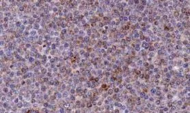 Immunohistochemistry paraffin embedded sections - Anti-Noxa antibody [114C307] (AB13654)