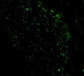 Immunocytochemistry/ Immunofluorescence - Anti-Noxa antibody (AB36833), expandable thumbnail