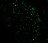 Immunocytochemistry/ Immunofluorescence - Anti-Noxa antibody (AB36833)