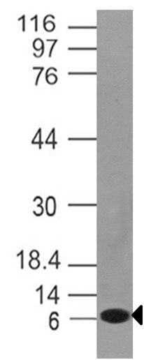 Western blot - Anti-Noxa antibody [ABM46B8] (AB220177), expandable thumbnail