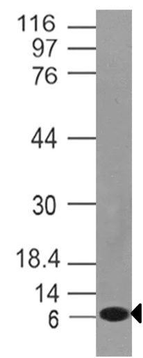 Western blot - Anti-Noxa antibody [ABM46B8] (AB220177)