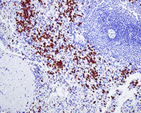 Immunohistochemistry (Formalin/PFA-fixed paraffin-embedded sections) - Anti-NOXA2/p67phox antibody [EPR5064] - BSA and Azide free (AB239969)