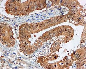 Immunohistochemistry (Formalin/PFA-fixed paraffin-embedded sections) - Anti-NOXA2/p67phox antibody [EPR5065] - BSA and Azide free (AB247891), expandable thumbnail