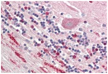 Immunohistochemistry (Formalin/PFA-fixed paraffin-embedded sections) - Anti-NP-I antibody (AB191201)