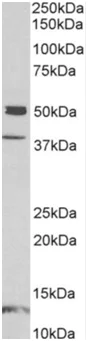 Western blot - Anti-NP-I antibody (AB191201)