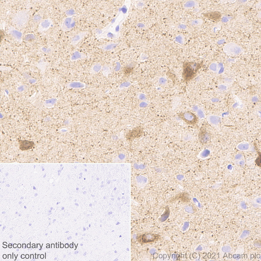 Immunohistochemistry (Formalin/PFA-fixed paraffin-embedded sections) - Anti-NP-I antibody [EPR25683-64] - BSA and Azide free (AB289990), expandable thumbnail