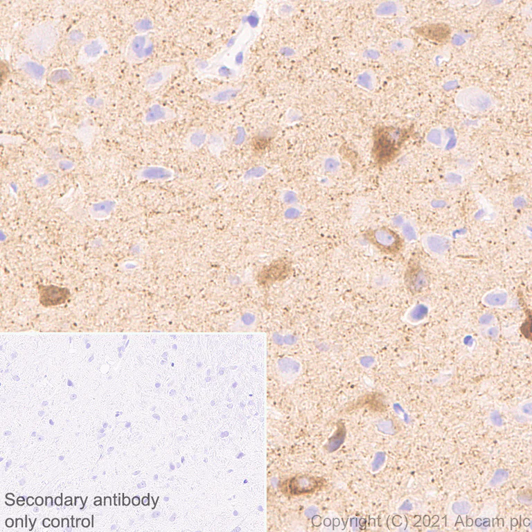 Immunohistochemistry (Formalin/PFA-fixed paraffin-embedded sections) - Anti-NP-I antibody [EPR25683-64] - BSA and Azide free (AB289990)