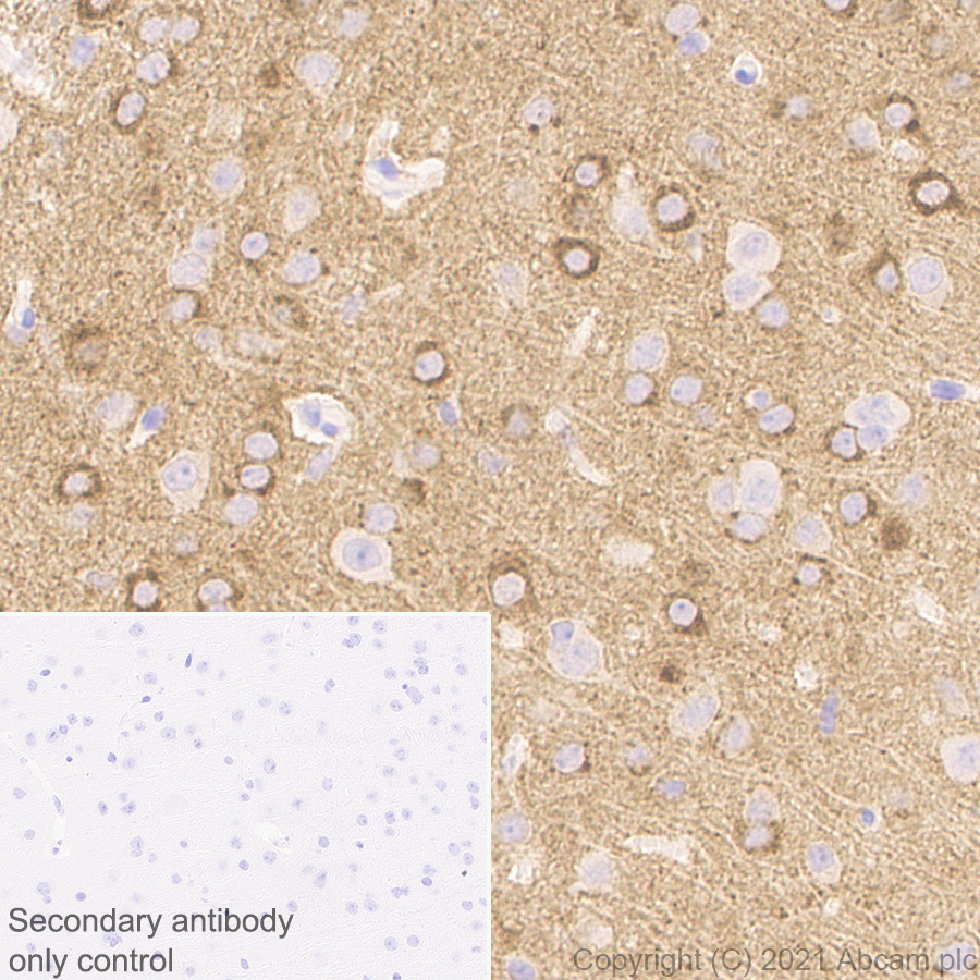Immunohistochemistry (Formalin/PFA-fixed paraffin-embedded sections) - Anti-NP-I antibody [EPR25683-64] - BSA and Azide free (ab289990), expandable thumbnail