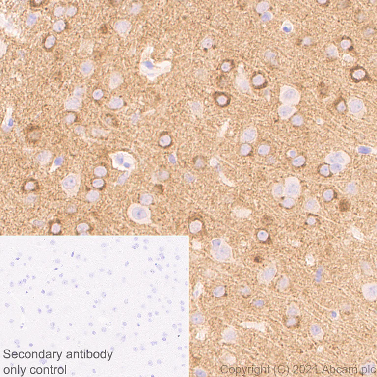 Immunohistochemistry (Formalin/PFA-fixed paraffin-embedded sections) - Anti-NP-I antibody [EPR25683-64] - BSA and Azide free (AB289990)