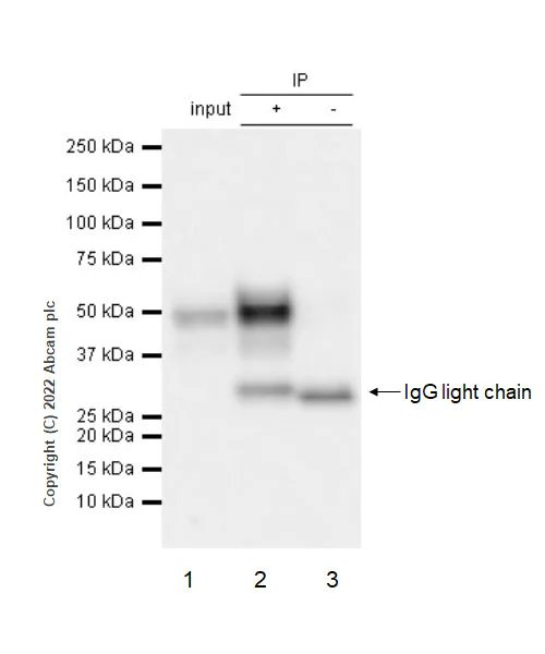 Immunoprecipitation - Anti-NP-I antibody [EPR25683-64] - BSA and Azide free (AB289990)