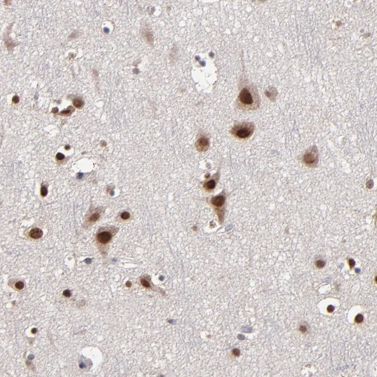 Immunohistochemistry (Formalin/PFA-fixed paraffin-embedded sections) - Anti-NPAS3 antibody (AB254662)