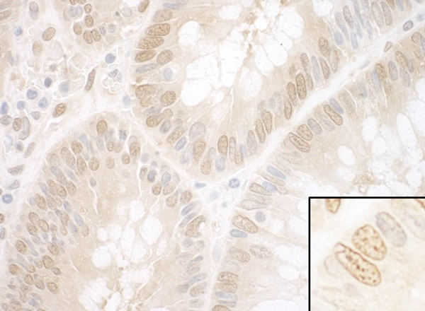 Immunohistochemistry (Formalin/PFA-fixed paraffin-embedded sections) - Anti-NPAT antibody (AB99436), expandable thumbnail