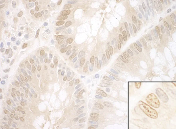 Immunohistochemistry (Formalin/PFA-fixed paraffin-embedded sections) - Anti-NPAT antibody (AB99436)