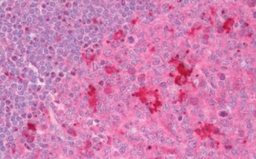 Immunohistochemistry (Formalin/PFA-fixed paraffin-embedded sections) - Anti-NPHP1 antibody (AB211422)