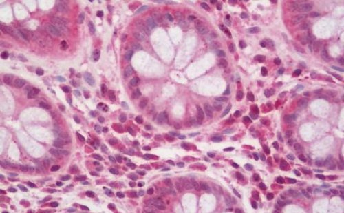 Immunohistochemistry (Formalin/PFA-fixed paraffin-embedded sections) - Anti-NPHP1 antibody (AB211422)