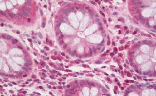 Immunohistochemistry (Formalin/PFA-fixed paraffin-embedded sections) - Anti-NPHP1 antibody (AB211422)
