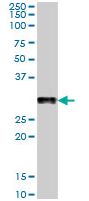 Western blot - Anti-NPHS2 antibody (AB168625)