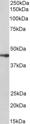 Western blot - Anti-NPHS2 antibody (AB177242)